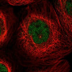 CCDC19 Antibody, Novus Biologicals 25 &mu;L; Unlabeled:Antibodies, Polyclonal
